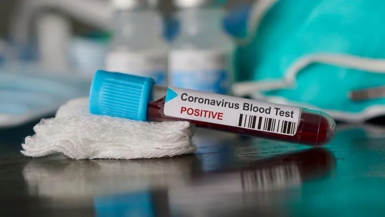 Organizația Mondială a Sănătății a declarat pandemie de coronavirus