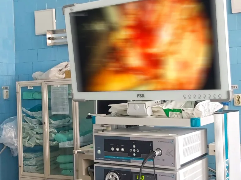 Premieră: medicii urologi de la Spitalul Județean Galați au realizat o operație de nefrectomie laparoscopică