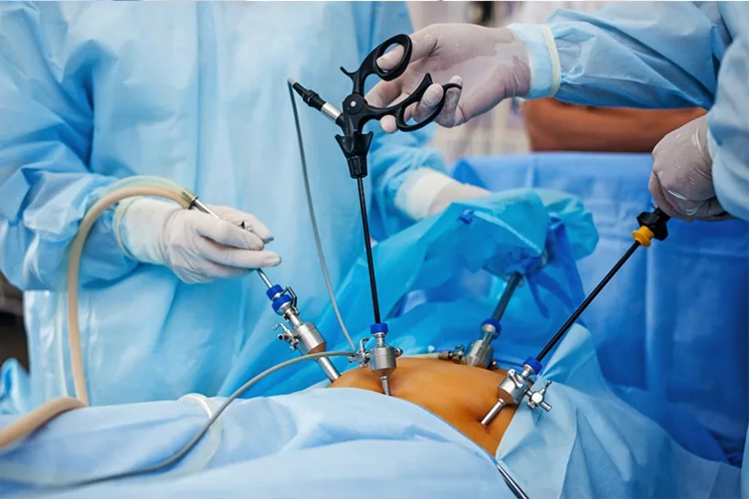„Un miracol medical”: bărbat operat după zece zile de agonie cu hernie strangulată